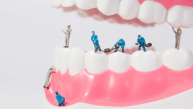 trattamento-paradontologia