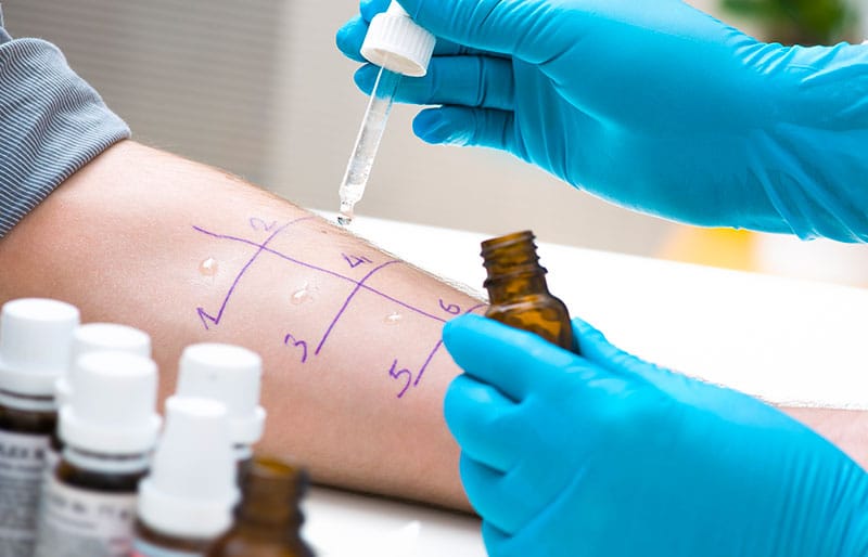 visita_allergologica_1