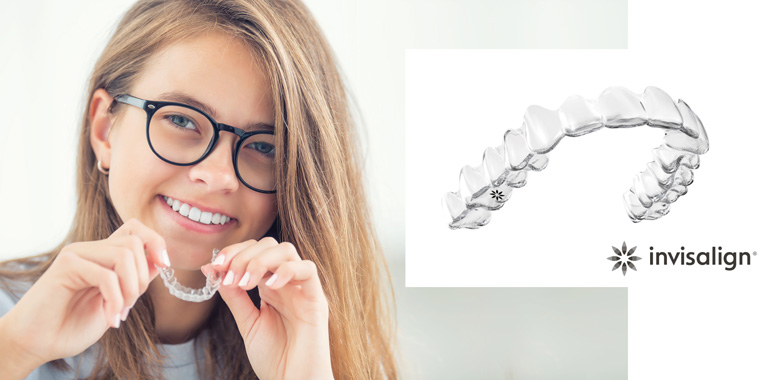 apparecchio-denti-invisibile-invisalign
